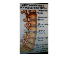 Bolovi,povrede i deformiteti kicme