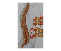 Uporne glavobolje, nesanice, nesvestice